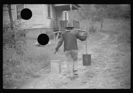 0757_Man with rudimentary yolk